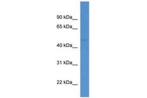 Image no. 1 for anti-Neutral Cholesterol Ester Hydrolase 1 (NCEH1) (AA 224-273) antibody (ABIN6746306) (NCEH1 Antikörper  (AA 224-273))