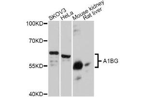 Western blot analysis of extracts of various cell lines, using A1BG Antibody (ABIN5997159) at 1:3000 dilution. (A1BG Antikörper)