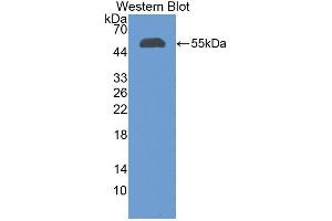 Western blot analysis of recombinant Human CFI. (Complement Factor I Antikörper  (AA 28-243))