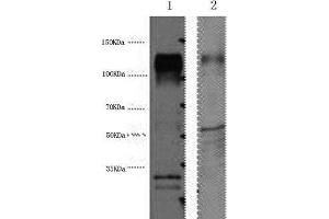 Western Blot analysis of 1) Hela, 2) Mouse brain using ERBB2 Monoclonal Antibody at dilution of 1:4000. (ErbB2/Her2 Antikörper)