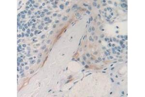 IHC-P analysis of Human Tissue, with DAB staining. (PSCA Antikörper  (AA 22-123))