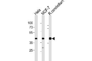 Western blot analysis of lysates from Hela, MCF-7 cell line, rat cerebellum tissue lysate(from left to right), using LTM4B Antibody (4) 20871a. (LAPTM4B Antikörper  (AA 195-209))