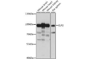 Western blot analysis of extracts of various cell lines, using ELP2 antibody (ABIN7266926) at 1:1000 dilution. (ELP2 Antikörper  (AA 300-600))