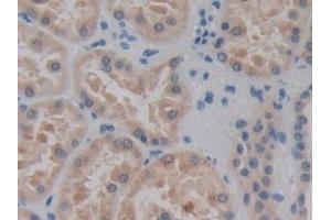 Immunohistochemistry (IHC) image for anti-Cadherin EGF LAG Seven Pass G-Type Receptor 3 (CELSR3) (AA 1181-1421) antibody (ABIN7443452)