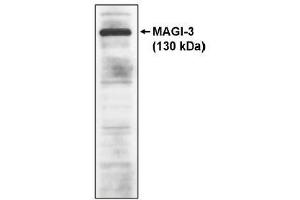 Image no. 1 for anti-Membrane Associated Guanylate Kinase, WW and PDZ Domain Containing 3 (MAGI3) antibody (ABIN264919) (MAGI3 Antikörper)