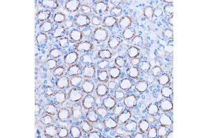 Immunohistochemistry of paraffin-embedded mouse kidney using MT-ND3 antibody (ABIN7268601) at dilution of 1:100 (40x lens).