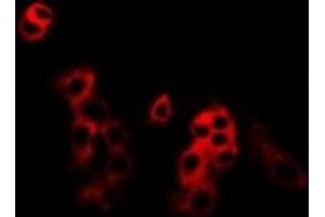 Immunofluorescent analysis of MKK5 staining in U2OS cells. (MAP2K5 Antikörper)