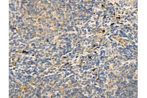 ABIN6260655 and ABIN6268781 at 1/100 staining Mouse spleen tissue by IHC-P. (CD83 Antikörper  (Internal Region))