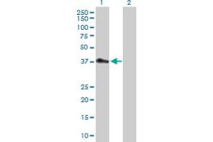 Western Blot analysis of PDCD2L expression in transfected 293T cell line by PDCD2L MaxPab polyclonal antibody. (PDCD2L Antikörper  (AA 1-358))