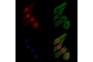ABIN6256220 and ABIN6267281 staining HepG2 cells(30 min of 4uM Forskolin treatment) by IF/ICC.
