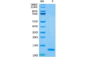 Human Mature TGF beta 2 on Tris-Bis PAGE under reduced condition. (TGFB2 Protein (AA 303-414))