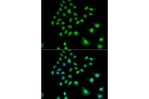 Immunofluorescence analysis of U2OS cells using UBE3C antibody. (UBE3C Antikörper)
