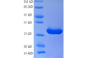 SDS-PAGE (SDS) image for Solute Carrier Family 26, Member 3 (SLC26A3) (AA 28-254) protein (His tag) (ABIN4976131)