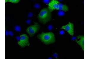 Image no. 7 for anti-Transforming, Acidic Coiled-Coil Containing Protein 3 (TACC3) antibody (ABIN1498098) (TACC3 Antikörper)