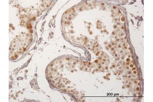 Immunostaining (ISt) image for anti-F-Box Protein 7 (FBXO7) (AA 1-522) antibody (ABIN1327602)