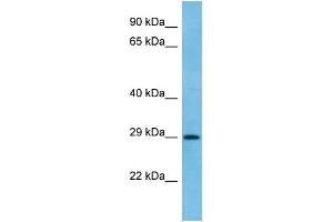 WB Suggested Anti-RAB6C Antibody Titration: 1. (WTH3DI Antikörper  (C-Term))