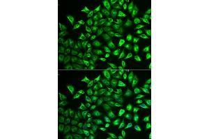 Immunofluorescence analysis of U2OS cells using MMRN1 antibody (ABIN5974009). (Multimerin 1 Antikörper)