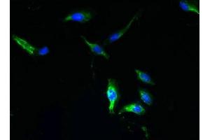 Immunofluorescent analysis of Hela cells using ABIN7166225 at dilution of 1:100 and Alexa Fluor 488-congugated AffiniPure Goat Anti-Rabbit IgG(H+L) (TTYH1 Antikörper  (AA 50-178))