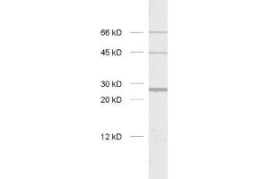 dilution: 1 : 1000, sample: rat brain homogenate (CHRNB1 Antikörper)