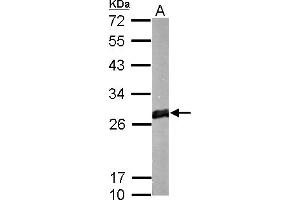 WB Image GSTM1 antibody detects protein by Western blot analysis. (GSTM1 Antikörper)