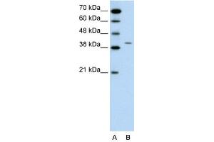 RAPSN antibody used at 0. (RAPSN Antikörper  (N-Term))