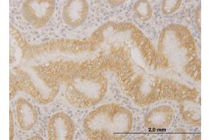 Immunoperoxidase of monoclonal antibody to PCDHA10 on formalin-fixed paraffin-embedded human stomach. (PCDHA10 Antikörper  (AA 182-290))