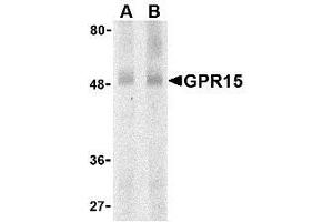 Western blot analysis of GPR15 in human spleen lysate with AP30376PU-N GPR15 antibody at (A) 0. (GPR15 Antikörper  (N-Term))