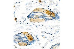 Immunohistochemistry (Paraffin-embedded Sections) (IHC (p)) image for anti-Keratin 13 (KRT13) (C-Term) antibody (ABIN7074411)