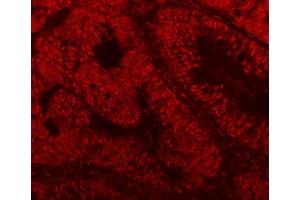 IF analysis of SF3A3 using anti-SF3A3 antibody (ABIN7599863).