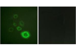 Immunofluorescence analysis of A549 cells, using c-Met (epitope around residue 1003) antibody. (c-MET Antikörper  (Tyr1003))