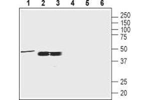 Western blot analysis of rat brain membrane (1:200), rat testis and mouse testis lysates (1:400): - 1-3. (Oxytocin Receptor Antikörper  (C-Term, Intracellular))