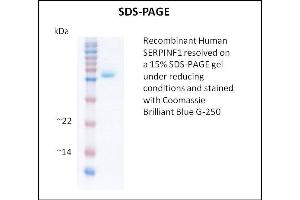 SDS-PAGE (SDS) image for serpin Peptidase Inhibitor, Clade F (Alpha-2 Antiplasmin, Pigment Epithelium Derived Factor), Member 1 (SERPINF1) (Active) protein (ABIN5509380)