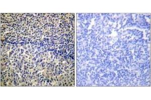 Immunohistochemistry analysis of paraffin-embedded human tonsil tissue, using p47 phox (Ab-328) Antibody. (NCF1 Antikörper  (AA 301-350))