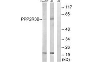 Western blot analysis of extracts from Jurkat/HuvEc cells, using PPP2R5D Antibody. (PPP2R5D Antikörper  (AA 544-593))