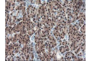 Immunohistochemical staining of paraffin-embedded Human pancreas tissue using anti-PGM3 mouse monoclonal antibody.