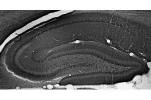 Adult rat hippocampus immunohistochemistry. (Peroxisomal Biogenesis Factor 5-Like (PEX5L) (AA 1-192), (Constant Region) Antikörper)