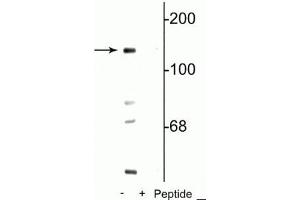 Western blot of mouse brain lysate showing specific immunolabeling of the ~140 kDa NR2C   subunit of the NMDA receptor phosphorylated at Ser1096 in the first lane (-). (GRIN2C Antikörper  (pSer1096))