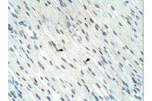 Image no. 1 for anti-SERTA Domain Containing 1 (SERTAD1) (N-Term) antibody (ABIN324352) (SERTAD1 Antikörper  (N-Term))