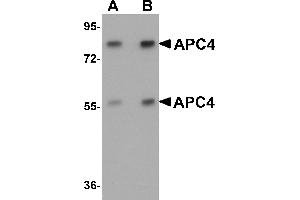 Western Blotting (WB) image for anti-Anaphase Promoting Complex Subunit 4 (ANAPC4) (N-Term) antibody (ABIN1031231) (ANAPC4 Antikörper  (N-Term))