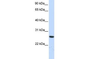 WB Suggested Anti-TTC33 Antibody Titration: 0. (TTC33 Antikörper  (N-Term))
