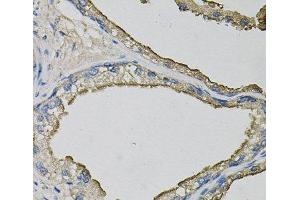 Immunohistochemistry of paraffin-embedded Human prostate using LCN1 Polyclonal Antibody at dilution of 1:100 (40x lens). (Lipocalin 1 Antikörper)