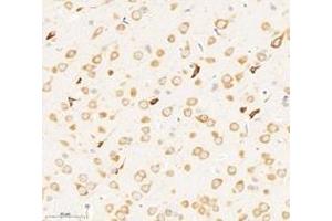 Immunohistochemistry analysis of paraffin-embedded rat brain using,RPL8 (ABIN7075442) at dilution of 1: 3000