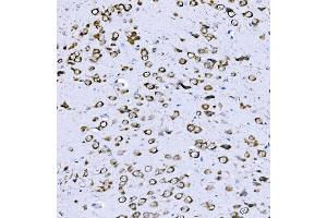 IHC analysis of VPRBP/DCAF1 using anti-VPRBP/DCAF1 antibody (ABIN7602005). (DDB1 and CUL4-Associated Factor 1 (DCAF1) (AA 540-861) Antikörper)