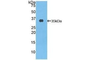 Detection of Recombinant ABCA3, Human using Polyclonal Antibody to ATP Binding Cassette Transporter A3 (ABCA3) (ABCA3 Antikörper  (AA 1358-1635))