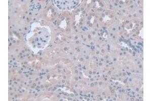 Detection of IFNg in Rat Kidney Tissue using Polyclonal Antibody to Interferon Gamma (IFNg) (Interferon gamma Antikörper  (AA 23-156))