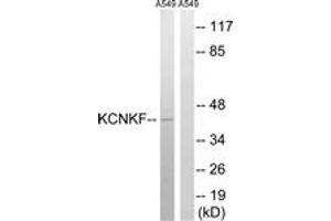 Western blot analysis of extracts from A549 cells, using KCNK15 Antibody. (KCNK15 Antikörper  (AA 273-322))