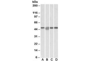 Western blot testing of Daudi [A], Jurkat [B], K562 [C] and MOLT4 [D] lysates with MAP2K2 antibody at 0. (MEK2 Antikörper)