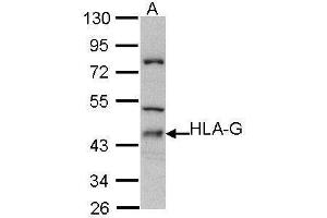 WB Image Sample (30 ug of whole cell lysate) A: Molt-4 , 10% SDS PAGE antibody diluted at 1:500 (HLAG Antikörper)