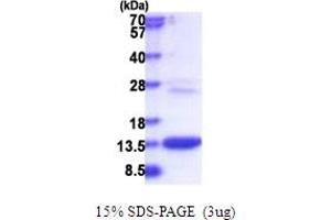 SDS-PAGE (SDS) image for COMM Domain Containing 6 (COMMD6) (AA 1-85) protein (His tag) (ABIN5853820)