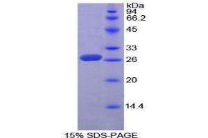 SDS-PAGE analysis of Mouse Sp100 Nuclear Antigen Protein. (SP100 Protein)
